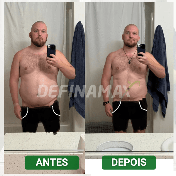 Antes e depois