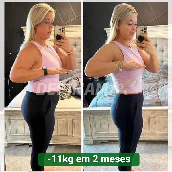 Antes e Depois